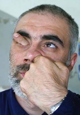 Les+doigts+dans+le+nez.jpg